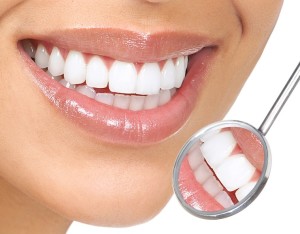 Estética Dental antes e depois do tratamento 2