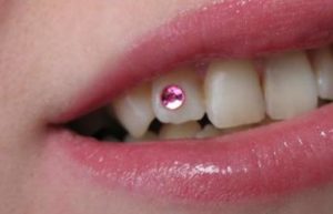 Fotos de piercing feminino no dente 7