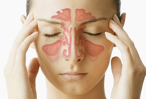 Congestão nasal remédio caseiro